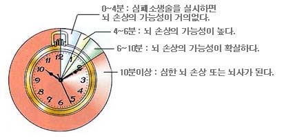 심폐소생술과 뇌손상의 관계